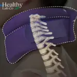 CerviCorrect Neck Brace Vayota™ (Chrismast Sale) - Image 2